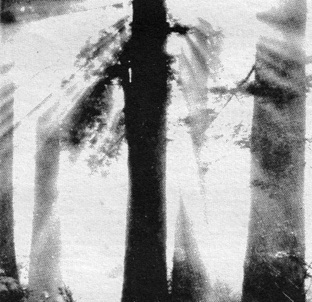 Tree_Sun_Web-sq